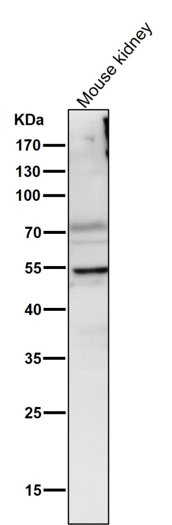 LPL Antibody Mouse Kidney Western Blot. Western blot analysis of mouse kidney tissue lysate using LPL Antibody demonstrates a prominent band at approximately 55 kDa, consistent with expression of Lipoprotein Lipase (LPL). LPL is a key enzyme involved in triglyceride hydrolysis, fatty acid mobilization, and lipid utilization, facilitating the release of free fatty acids from circulating lipoproteins for cellular uptake and metabolic activity. Detection of LPL in kidney tissue is consistent with the importance of lipid metabolism and energy homeostasis in renal physiology. Lane probed using antibody diluted 1:2000 for 1 hour at room temperature.