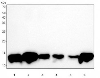 FABP1 Antibody Liver Tissue and Cell Line WB. Western blot testing of 1) human HCCT, 2) human HCCP, 3) human HepG2, 4) rat liver, 5) rat RH35 and 6) mouse liver tissue lysate with FABP1 antibody. Predicted molecular weight ~14 kDa.