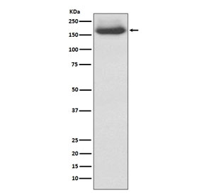 NF-M Antibody Human 293T Cell WB. Western blot testing of human 293T cell lysate using NF-M Antibody, clone AAGI-14. A prominent band is detected at approximately 145-160 kDa, consistent with the characteristic migration of heavily phosphorylated neurofilament medium chain, despite a predicted molecular weight of approximately 102 kDa. The slower electrophoretic mobility reflects extensive post-translational phosphorylation, a well-established feature of NF-M. These results demonstrate that NF-M Antibody, a Neurofilament Medium Chain Antibody, specifically detects endogenous NF-M in human cells.