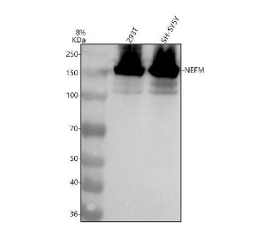 NF-M Antibody Human 293T and SH-SY5Y WB. Western blot analysis of human 293T and SH-SY5Y cell lysates using NF-M Antibody. Lane 1: 293T whole cell lysate. Lane 2: SH-SY5Y whole cell lysate. Samples (30 ug/lane) were separated on an 8% SDS-PAGE gel under reducing conditions, transferred to a nitrocellulose membrane, and detected with NF-M Antibody followed by an HRP-conjugated secondary antibody and ECL detection. A strong band is observed at approximately 160 kDa, migrating above the predicted molecular weight of approximately 102 kDa due to the extensive phosphorylation characteristic of neurofilament medium chain. These results demonstrate that NF-M Antibody, a Neurofilament Medium Chain Antibody, specifically detects endogenous NEFM in human cells.