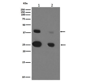 CTSD Antibody MCF7 and SK-BR-3 WB. Western blot testing of human 1) MCF7 and 2) SK-BR-3 cell lysate with CTSD antibody. Expected molecular weight: 43-46 kDa and 28 kDa (heavy chain).