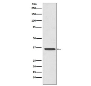 ANXA2 Antibody ABDG-1 in Human HeLa Cervical Cancer Cells WB. Western blot testing of clone ABDG-1 in human HeLa cervical cancer cell lysate. A prominent band is observed at approximately 36-38 kDa, consistent with the expected molecular weight of Annexin A2 (~39 kDa). This ANXA2 Antibody demonstrates detection of endogenous Annexin II in human cells.