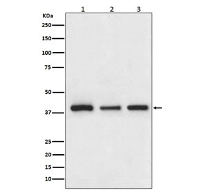 Cathepsin L/V/K/H Antibody WB. Western blot testing of 1) human HepG2, 2) mouse NIH3T3 and 3) rat PC-12 cell lysate with Cathepsin L/V/K/H antibody.