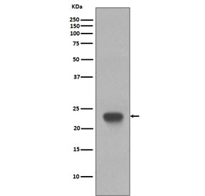CD3 epsilon Antibody Western Blot. Analysis of CD3 Epsilon / CD3E detection in human Jurkat cell lysate using CD3 epsilon Antibody / T Cell Activation Marker Antibody. Lane 1: human Jurkat cell lysate. A band is observed at approximately 23 kDa, consistent with the predicted molecular weight of CD3 epsilon. The strong, well-defined signal supports reliable detection of this T-cell activation-associated protein in T-cell-derived lysates.