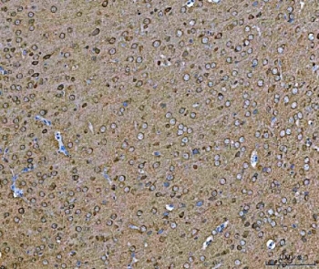 IHC staining of FFPE mouse brain tissue with HSP90 alpha/beta antibody. HIER: boil tissue sections in pH8 EDTA for 20 min and allow to cool before testing.