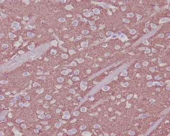 Synaptophysin Antibody Recombinant Rabbit MAb Clone BGB-19. Immunohistochemistry analysis of FFPE mouse brain tissue demonstrates widespread cytoplasmic HRP-DAB brown staining within neurons and surrounding neuropil, consistent with Synaptophysin (SYP) localization in presynaptic vesicle membranes. The staining pattern highlights synapse-rich neuronal regions where synaptic vesicles are densely distributed along neuronal processes. Hematoxylin counterstain marks nuclei in blue. The recombinant rabbit monoclonal Synaptophysin antibody clone BGB-19 was used to detect synaptic vesicle protein expression in mouse brain tissue. Heat-induced epitope retrieval was performed by boiling tissue sections in pH6 10mM citrate buffer for 10-20 minutes followed by cooling prior to staining.