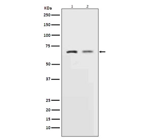 Western blot testing of 1) rat L6 and 2) human HeLa cell lysate with MMP2 antibody. Expected molecular weight: ~72 kDa (pro form), ~63 kDa (cleaved form).