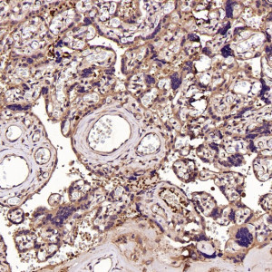 CD41 Antibody AAGH-9 Staining in Human Placenta by IHC. Immunohistochemistry of paraffin-embedded human placenta using CD41 Antibody (clone AAGH-9) at a 1:50 dilution shows widespread brown staining associated with placental villous structures. Signal is visible along and within numerous villi, with blue hematoxylin-counterstained nuclei providing clear tissue contrast. The heterogeneous but extensive staining demonstrates detection of CD41/ITGA2B in human placental tissue using this ITGA2B Monoclonal Antibody.