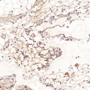 CD41 Antibody AAGH-9 Staining in Rat Pancreas by IHC. Immunohistochemistry of paraffin-embedded rat pancreas using CD41 Antibody (clone AAGH-9) at a 1:50 dilution shows relatively light, localized brown staining within the pancreatic tissue. Signal is present along portions of the tissue architecture and in scattered cellular structures, while much of the field remains lightly stained. The observed cross-species reactivity demonstrates recognition of rat ITGA2B using this ITGA2B Monoclonal Antibody.