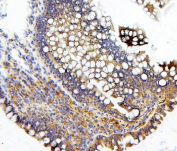 IHC staining of FFPE rat intestine with CDC42 antibody. HIER: boil tissue sections in pH8 EDTA for 20 min and allow to cool before testing.