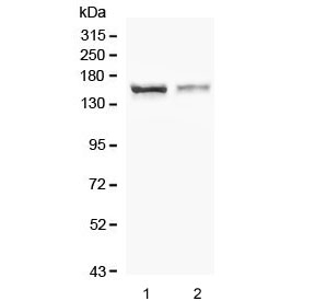 Western blot testing of human 1) HEK293 and 2) U-87 MG cell lysate with CRB1 antibody. Predicted molecular weight ~154 kDa.