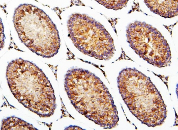 IHC staining of FFPE rat testis with CRB1 antibody. HIER: boil tissue sections in pH6, 10mM citrate buffer, for 20 min and allow to cool before testing.