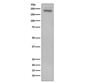 Western blot testing of human Jurkat cell lysate with CD45 antibody. Expected molecular weight: 147-220 kDa depending on glycosylation level.