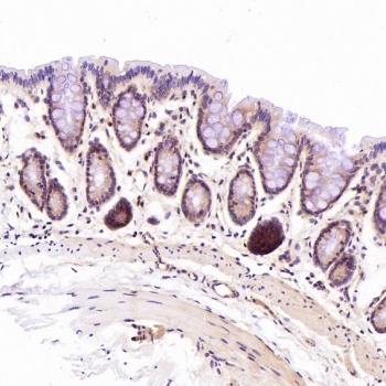 IHC staining of FFPE rat stomach tissue with CD45 antibody. HIER: boil tissue sections in pH6, 10mM citrate buffer, for 10-20 min and allow to cool before testing.