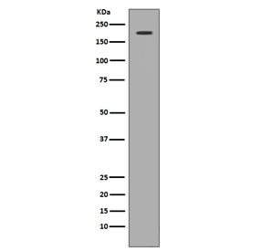 Western blot testing of human 293 cell lysate with c-Met antibody. Predicted molecular weight ~156 kDa.