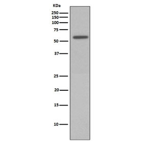 Phospho-Vimentin (Ser72) Antibody / Mitotic Marker Antibody Calyculin A-Treated HeLa WB. Western blot analysis of lysate from Calyculin A-treated HeLa cells using Phospho-Vimentin (Ser72) Antibody / Mitotic Marker Antibody. A distinct immunoreactive band is detected at approximately 53-58 kDa, consistent with the expected molecular weight of phosphorylated vimentin. Calyculin A treatment inhibits protein phosphatases, promoting accumulation of serine 72-phosphorylated vimentin and demonstrating the antibody's specificity for the phosphorylated form of the protein during mitotic signaling and cytoskeletal remodeling.