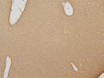 IHC staining of FFPE mouse liver with CYP2C19 antibody. HIER: boil tissue sections in pH8 EDTA for 20 min and allow to cool before testing.