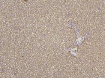 IHC staining of FFPE rat liver with CYP2C19 antibody. HIER: boil tissue sections in pH8 EDTA for 20 min and allow to cool before testing.