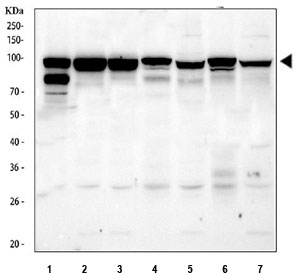 EZH2 Antibody Human Mouse, Rat WB. Western blot testing of 1) human Jurkat, 2) human K562, 3) human MCF7, 4) rat spleen, 5) rat testis, 6) mouse spleen and 7) mouse testis tissue lysate with EZH2 antibody. Predicted molecular weight: 85-95 kDa.
