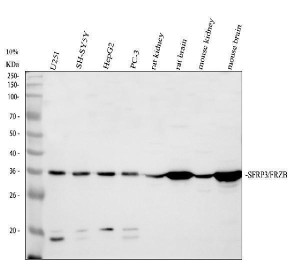 FRZB Antibody Human, Mouse and Rat WB. Western blot analysis detected FRZB in human U251 (lane 1), SH-SY5Y (lane 2), HepG2 (lane 3) and PC-3 (lane 4) cell lysates, as well as rat kidney (lane 5), rat brain (lane 6), mouse kidney (lane 7) and mouse brain (lane 8). A specific immunoreactive band was observed at approximately 36 kDa, consistent with the predicted molecular weight of FRZB. Stronger expression was evident in rat and mouse brain tissues, reflecting the importance of this secreted Wnt signaling regulator in neural development and tissue homeostasis. This FRZB Antibody, a Secreted Wnt Antagonist Antibody, demonstrates cross-species reactivity for studies of Wnt signaling, skeletal development and extracellular pathway regulation.