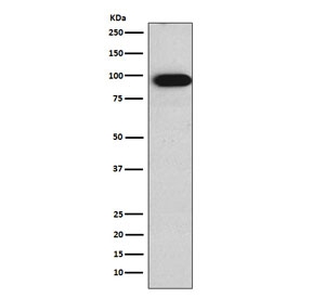 Villin Antibody for WB. Western blot analysis of Villin-1 (VIL1) using human Caco-2 cell lysate with Villin Antibody / Cytoskeletal Remodeling Protein Antibody (clone AFOA-22). Lane 1: human Caco-2 lysate. A band is detected at approximately 93 kDa, consistent with the predicted molecular weight of Villin-1 (VIL1). This signal aligns with the known high expression of Villin in differentiated intestinal epithelial cells and supports its role in dynamic actin remodeling within enterocyte cytoskeletal networks.