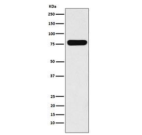 VIL1 Antibody for WB. Western blot analysis of Villin-1 (VIL1) using human Caco-2 cell lysate with VIL1 Antibody / Calcium-Regulated Actin Protein Antibody (clone VIL1/5521R). Lane 1: human Caco-2 lysate. A band is detected at approximately 93 kDa, consistent with the predicted molecular weight of Villin-1 (VIL1). This signal supports the presence of Villin in intestinal epithelial cells and aligns with its role as a calcium-regulated actin-binding protein involved in cytoskeletal signaling and filament dynamics.