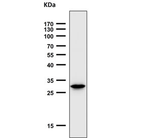 Western blot testing of mouse spleen lysate with Heme Oxygenase 1 antibody. Predicted molecular weight ~32 kDa.
