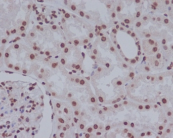 IHC staining of FFPE human kidney tissue with Cleaved PARP antibody. HIER: boil tissue sections in pH6, 10mM citrate buffer, for 10-20 min and allow to cool before testing.