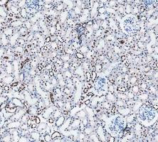 PARP1 Antibody Rat Kidney IHC. Immunohistochemistry analysis of FFPE rat kidney tissue using recombinant rabbit monoclonal PARP1 antibody clone CFD-16. Renal tubular epithelial cells demonstrate prominent nuclear HRP-DAB brown staining consistent with the chromatin-associated localization of PARP1 in DNA strand break repair and genomic stability maintenance pathways, while surrounding stromal regions show comparatively lower signal intensity. Nuclei are counterstained blue. Heat-mediated antigen retrieval was performed in pH8 EDTA buffer prior to staining.