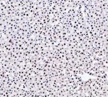 PARP1 Antibody Rat Liver IHC. Immunohistochemistry analysis of FFPE rat liver tissue using PARP1 Antibody / Chromatin Repair Protein Antibody. Hepatocyte nuclei demonstrate diffuse HRP-DAB brown staining consistent with the chromatin-associated localization of PARP1 in DNA repair, genomic stability maintenance, and oxidative stress-response signaling pathways within metabolically active hepatic tissue. Nuclei are counterstained blue. Heat-induced epitope retrieval was performed using EDTA buffer, pH8.0, prior to staining.