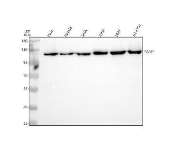 PARP1 Antibody Multi-Cell Line WB. Western blot analysis of human HeLa, HepG2, SIHA, K562, 293T, and SH-SY5Y whole cell lysates using recombinant rabbit monoclonal PARP1 antibody clone CFD-16. Lane 1: human HeLa lysate, Lane 2: human HepG2 lysate, Lane 3: human SIHA lysate, Lane 4: human K562 lysate, Lane 5: human 293T lysate, Lane 6: human SH-SY5Y lysate. A strong band is detected near 113 kDa across all tested samples, consistent with the predicted molecular weight of PARP1. The broad detection pattern supports the widespread expression of this chromatin-associated DNA repair enzyme involved in genomic stability maintenance, DNA strand break signaling, and nuclear stress response pathways across diverse human cell types.