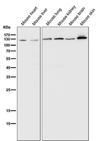 PARP1 Antibody Mouse Tissue WB. Western blot analysis of mouse heart, liver, lung, kidney, brain, and skin tissue lysates using recombinant rabbit monoclonal PARP1 antibody clone CFD-16 at 1:1000 dilution for 1 hour at room temperature. Lane 1: mouse heart lysate, Lane 2: mouse liver lysate, Lane 3: mouse lung lysate, Lane 4: mouse kidney lysate, Lane 5: mouse brain lysate, Lane 6: mouse skin lysate. A prominent band is detected near 113 kDa across all tested tissues, consistent with the predicted molecular weight of PARP1. The broad tissue distribution supports the role of this chromatin-associated DNA repair enzyme in genomic stability maintenance, nuclear stress surveillance, and DNA strand break signaling across metabolically active and proliferative mouse tissues.