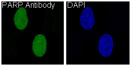 PARP1 Antibody HeLa IF. Immunofluorescence analysis of human HeLa cells using recombinant rabbit monoclonal PARP1 antibody clone CFD-16. PARP1 staining (green) demonstrates strong nuclear localization consistent with the chromatin-associated distribution of this DNA repair enzyme involved in genomic stability maintenance and DNA strand break response signaling. Nuclei are counterstained blue with DAPI.
