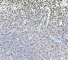 PARP1 Antibody Human Tonsil IHC. Immunohistochemistry analysis of FFPE human tonsil tissue using recombinant rabbit monoclonal PARP1 antibody clone CFD-16. Lymphoid cells demonstrate widespread nuclear HRP-DAB brown staining consistent with the role of PARP1 as a chromatin-associated DNA repair enzyme involved in genomic surveillance, stress-response signaling, and proliferative nuclear activity within immune cell populations. Nuclei are counterstained blue. Heat-mediated antigen retrieval was performed in pH8 EDTA buffer prior to staining.