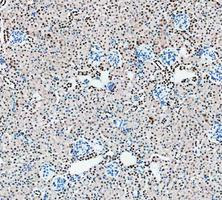 PARP1 Antibody Mouse Kidney IHC. Immunohistochemistry analysis of FFPE mouse kidney tissue using recombinant rabbit monoclonal PARP1 antibody clone CFD-16. Renal tubular epithelial cells and scattered interstitial cell populations demonstrate prominent nuclear HRP-DAB brown staining consistent with the chromatin-associated localization of PARP1 in DNA repair, genomic stability maintenance, and nuclear stress response signaling pathways. Nuclei are counterstained blue. Heat-mediated antigen retrieval was performed in pH8 EDTA buffer prior to staining.