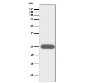 G-CSF Antibody K562 WB. Western blot testing of human K562 cell lysate with G-CSF antibody. Predicted molecular weight ~22 kDa.