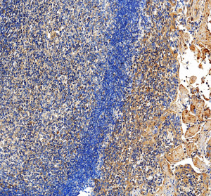 IL-31 Antibody in Human Tonsil Lymphoid and Epithelial Regions by IHC. Immunohistochemistry of FFPE human tonsil sections using IL-31 Antibody at 2 ug/ml. The image shows heterogeneous predominantly cytoplasmic brown staining across lymphoid cells, with stronger immunoreactivity visible in epithelial and stromal structures toward the tissue periphery. Dense lymphoid regions show comparatively weaker staining, producing clear regional contrast. HIER was performed using EDTA buffer at pH 8.0. This staining demonstrates tissue localization using the Interleukin 31 Polyclonal Antibody.