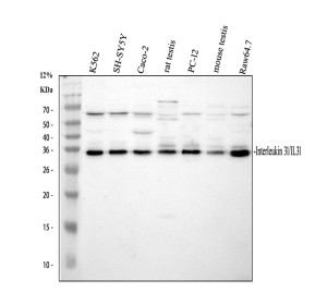 IL-31 Antibody in Human, Rat and Mouse Samples by WB. Western blot analysis using IL-31 Antibody with 30 ug of reduced lysate per lane. Lane 1: human K562 cells; lane 2: human SH-SY5Y cells; lane 3: human Caco-2 cells; lane 4: rat testis; lane 5: rat PC-12 cells; lane 6: mouse testis; lane 7: mouse RAW264.7 cells. A strong band is detected at approximately 30-35 kDa across all seven samples, compared with the calculated IL-31 molecular weight of 18.2 kDa. The higher apparent molecular weight may reflect post-translational modification and/or migration characteristics of endogenous IL-31. The result demonstrates cross-species detection with this Interleukin 31 Polyclonal Antibody.