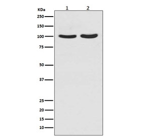 Western blot testing of human 1) T-47D and 2) LNCaP cell lysate with Androgen Receptor antibody. Predicted molecular weight ~99 kDa.