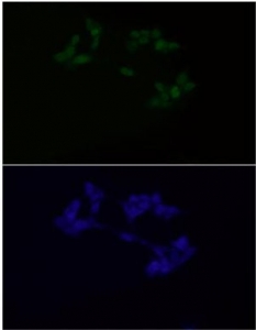 Immunofluorescent staining of FFPE human LNCaP cells with Androgen Receptor antibody (1:500, green) and DAPI nuclear stain (blue). HIER: steam section in pH6 citrate buffer for 20 min.