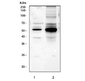 Western blot testing of 1) human SH-SY5Y and 2) mouse brain tissue lysate with Phospho-Tau antibody. The expected molecular weight of phosphorylated Tau (Ser198) is approximately 45-70 kDa, corresponding to the major Tau isoforms, and lower molecular weight bands around ~35 kDa may represent truncated Tau fragments commonly observed in brain tissue.