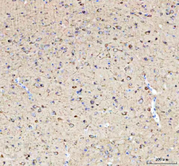 Western blot testing of 1) mouse brain and 2) rat brain tissue lysate with Phospho-Tau antibody. The expected molecular weight of phosphorylated Tau (Ser198) is approximately 45-70 kDa, corresponding to the major Tau isoforms, and lower molecular weight bands around ~35 kDa may represent truncated Tau fragments commonly observed in brain tissue.