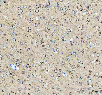 IHC staining of FFPE rat brain tissue with Phospho-Tau antibody, HRP-secondary and DAB substrate. HIER: boil tissue sections in pH8 EDTA for 20 min and allow to cool before testing.