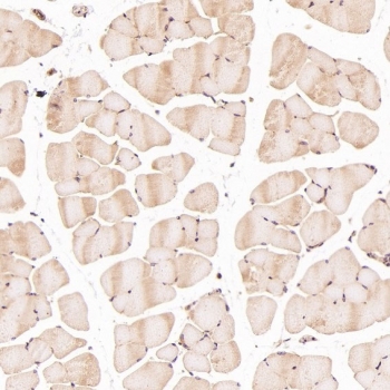 IHC staining of FFPE mouse skeletal muscle tissue with HAPLN1 antibody at 1:50. HIER: boil tissue sections in pH6 citrate buffer for 20 min and allow to cool before testing.