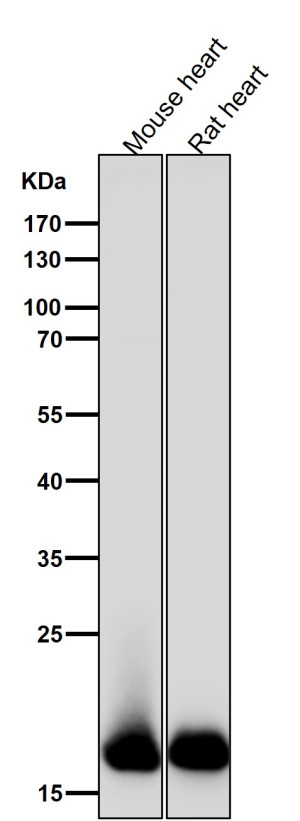 MLC2 Monoclonal Antibody FHO-13 by WB in Mouse and Rat Heart Western blot testing of mouse heart (lane 1) and rat heart (lane 2) lysates with MLC2 Monoclonal Antibody clone FHO-13 at a 1:5000 dilution. Strong bands are detected at approximately 19 kDa in both samples, consistent with the predicted molecular weight of MYL2/MLC2. The comparable target-sized signals demonstrate recognition of Myosin Light Chain 2 by this Myosin Light Chain 2 Rabbit Monoclonal in both mouse and rat cardiac tissue.