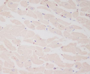 MLC2 Monoclonal Antibody FHO-13 by IHC in Human Heart Immunohistochemistry of FFPE human heart sections using MLC2 Monoclonal Antibody clone FHO-13. Cytoplasmic staining is observed throughout cardiomyocytes, consistent with localization of MYL2/MLC2 within the cardiac contractile apparatus. This Myosin Light Chain 2 Rabbit Monoclonal produces widespread myocardial labeling with limited nuclear staining.