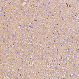 GLUT1 Antibody immunohistochemistry analysis in rat hippocampus tissue. FFPE rat hippocampus section shows HRP-DAB brown cytoplasmic and membranous staining in neuronal and neuropil regions consistent with GLUT1 (SLC2A1) localization in metabolically active brain tissue. The staining highlights cells within hippocampal layers while surrounding background remains minimal. The section was stained using GLUT1 antibody at 1:300 dilution.