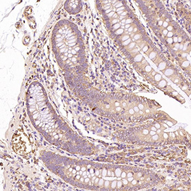 GLUT1 Antibody immunohistochemistry analysis in human colon tissue. FFPE human colon section shows HRP-DAB brown membranous and cytoplasmic staining in epithelial cells lining the colonic glands, consistent with GLUT1 (SLC2A1) localization in metabolically active epithelial cell populations. Stromal cells and surrounding connective tissue show minimal background staining. The section was stained using GLUT1 antibody at 1:200 dilution.