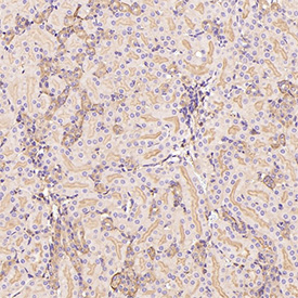 GLUT1 Antibody immunohistochemistry analysis in mouse kidney tissue. FFPE mouse kidney section shows HRP-DAB brown membranous and cytoplasmic staining in renal tubular epithelial cells, consistent with GLUT1 (SLC2A1) localization in metabolically active kidney cell populations. Glomerular structures and surrounding stromal regions show comparatively weaker staining. The section was stained using GLUT1 antibody at 1:300 dilution.