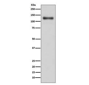 Western blot testing of human A431 cell lysate with CD107A antibody. This heavily glycosylated protein of 417 amino acids is visualized at up to 140 kDa.